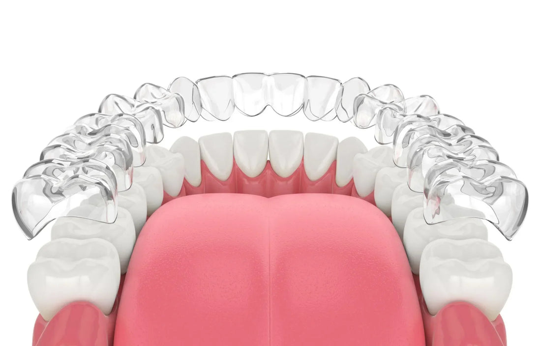 How to Clean Invisalign Aligners