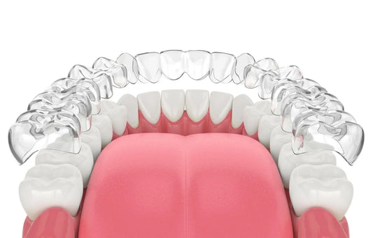 How to Clean Invisalign Aligners