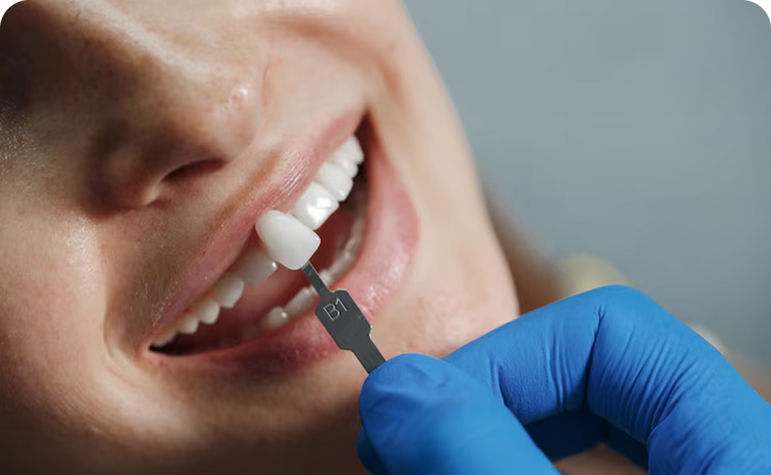 Why you should think twice before getting Dental implants