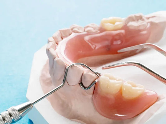 Dental Implants vs. Bridges: Which Is Right for You?